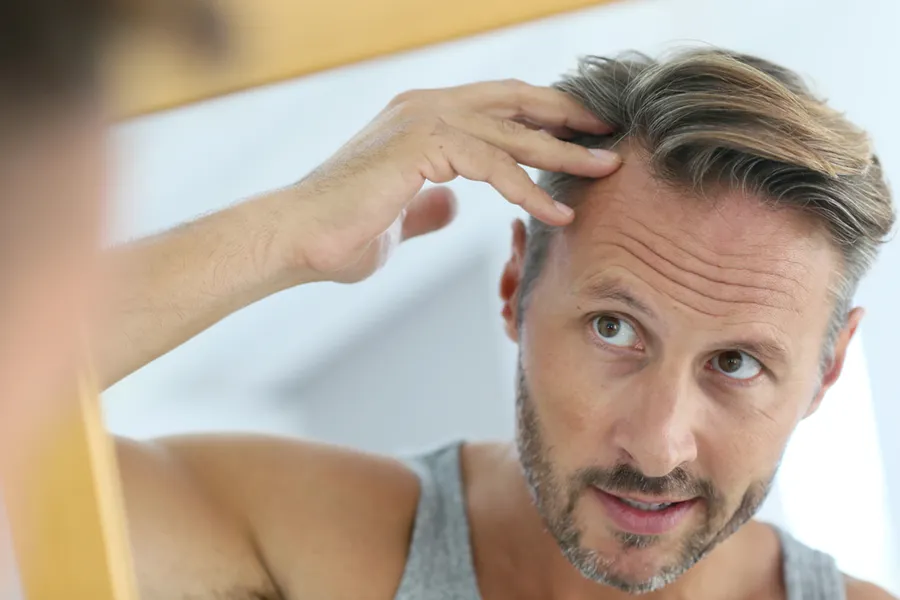 A middle-aged man checks his receding hairline in the mirror. Get Formula 82M for hair loss treatment from Carolyn Zaumeyer, MSN, APRN at LowTE Florida® in Greater Fort Lauderdale.
